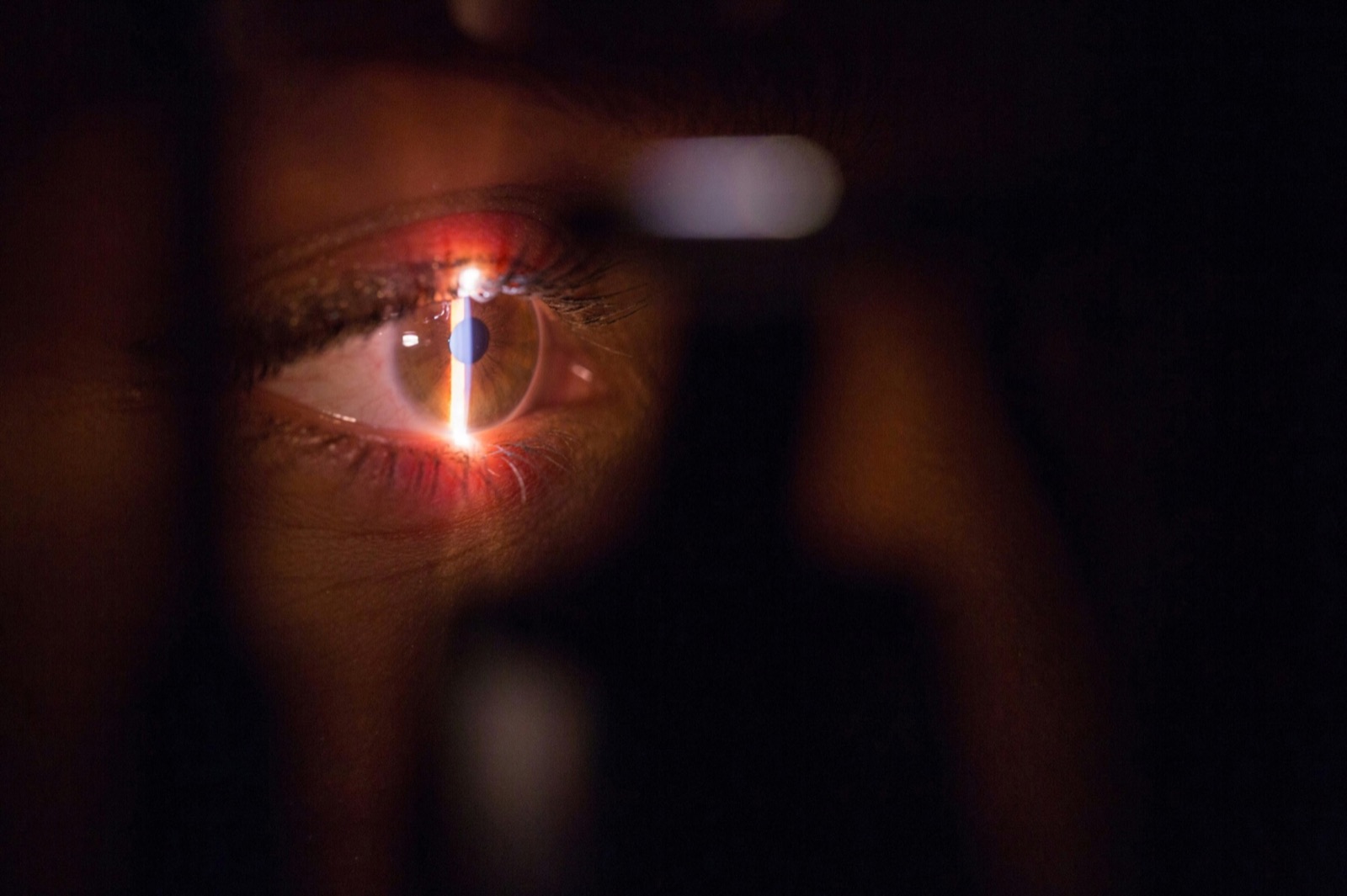 Controllo oculistico di prevenzione in studio